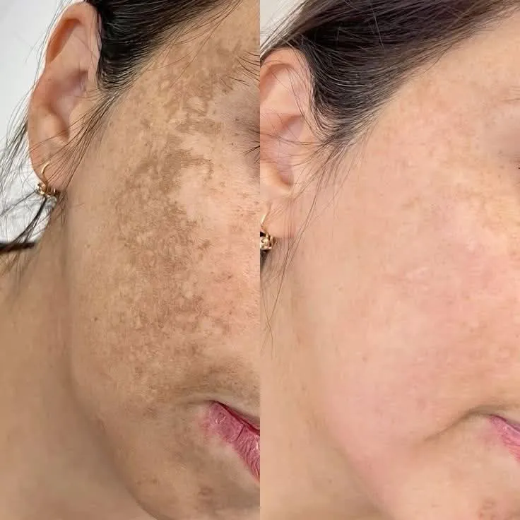 Skin Health